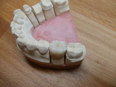 Zirkonoxid